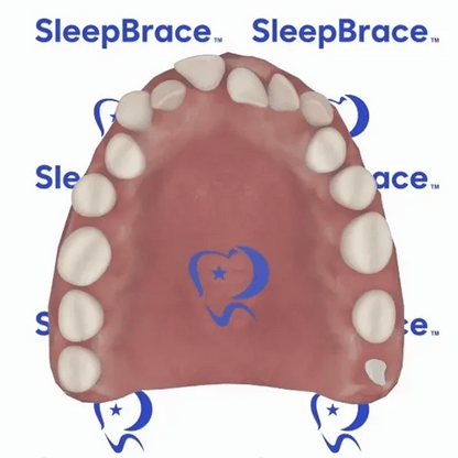 SleepBrace® Dental